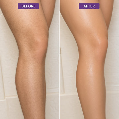 Hair Removal Kit